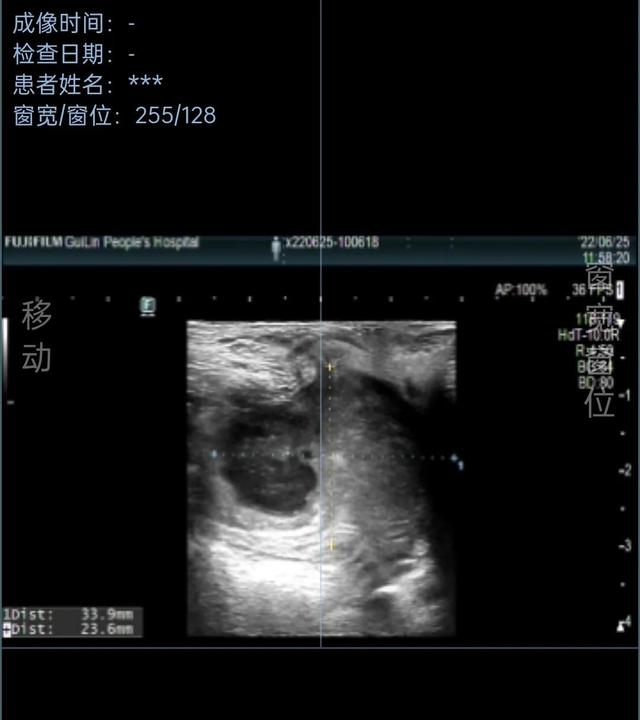 肛肠科出科小结(结直肠肛门外科出科小结)